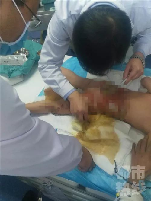 关于11岁男生向女童泼开水不需承担刑责的思考与探讨