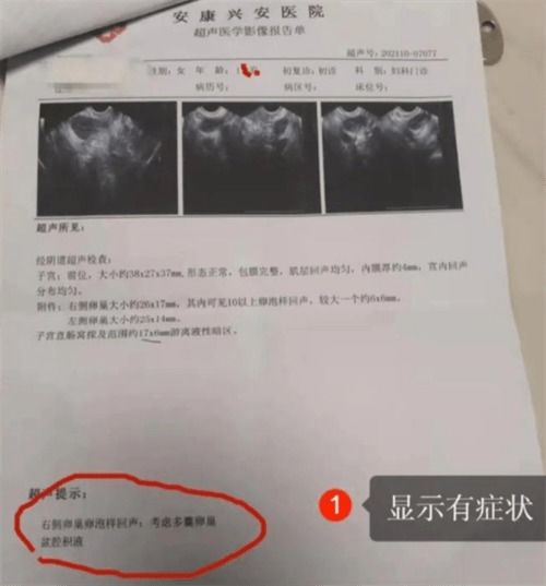 17岁女孩遭遇宫颈癌晚期，警示与反思