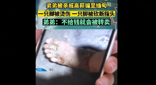 缅北反诈终极之战（81集）——深入解析打击缅北诈骗的艰巨挑战与全面胜利