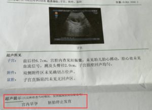 离婚后，她转身收到六胎孕检单（91集长篇连载）