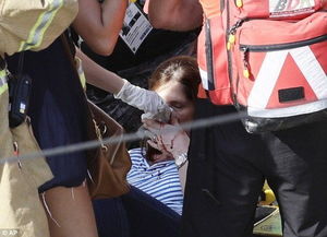 巴西女子日光浴遭遇不幸，头部被子弹击中