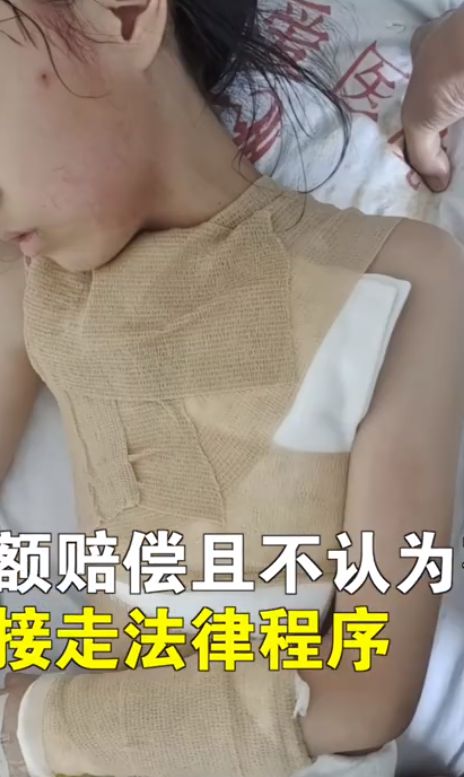 男子被火锅烫伤，白糖竟成神奇良药？