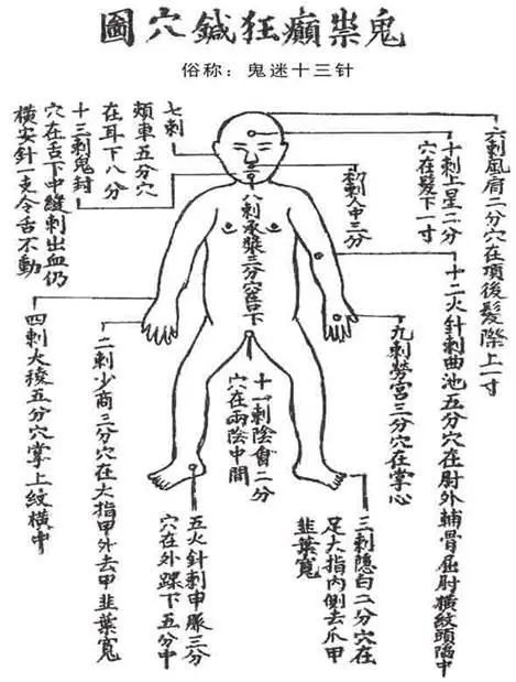 鬼门十三针，揭秘古老医术的奥秘（81集深度解析）