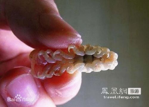 男子补牙遭遇意外，种植钻头掉进嘴巴里