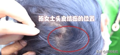 女子染发10多年，最终选择与白发和解