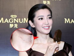前男友曝金赛纶脖子伤痕照，揭露背后的故事与争议