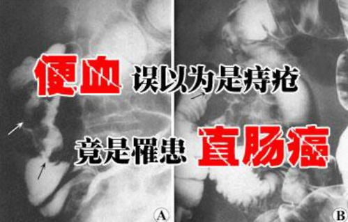 玫瑰故事之误诊后我横冲直撞（第82集）——钟熙的逆袭之路