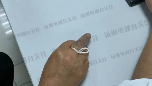 被毒蛇咬伤后的自救指南